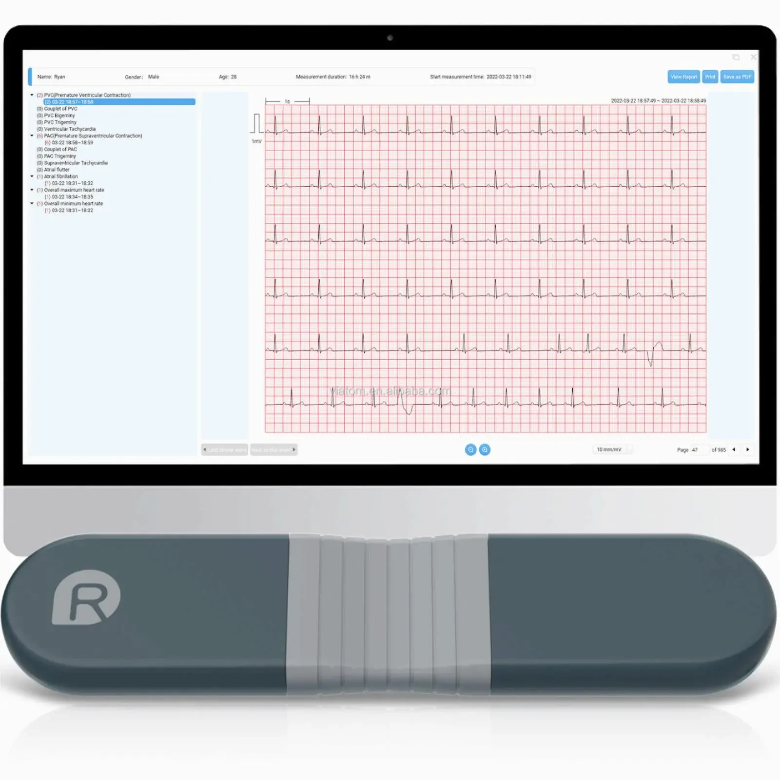 Беспроводной Bluetooth-динамич – обзор и цена Ecg Patch Monitor